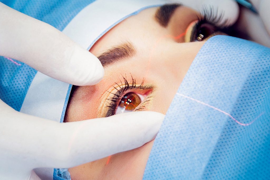 Femtolasik Bıçaksız Lasik Nedir?