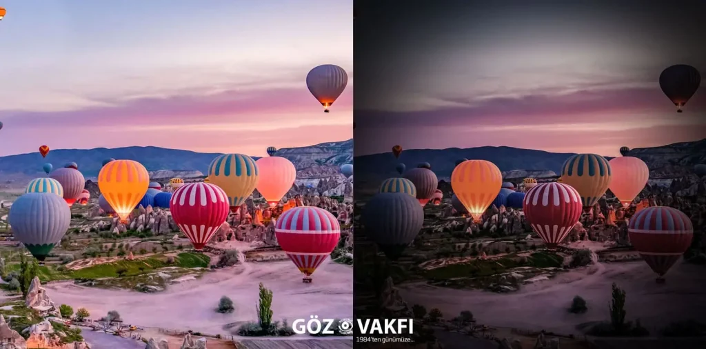Glokom (Göz Tansiyonu)