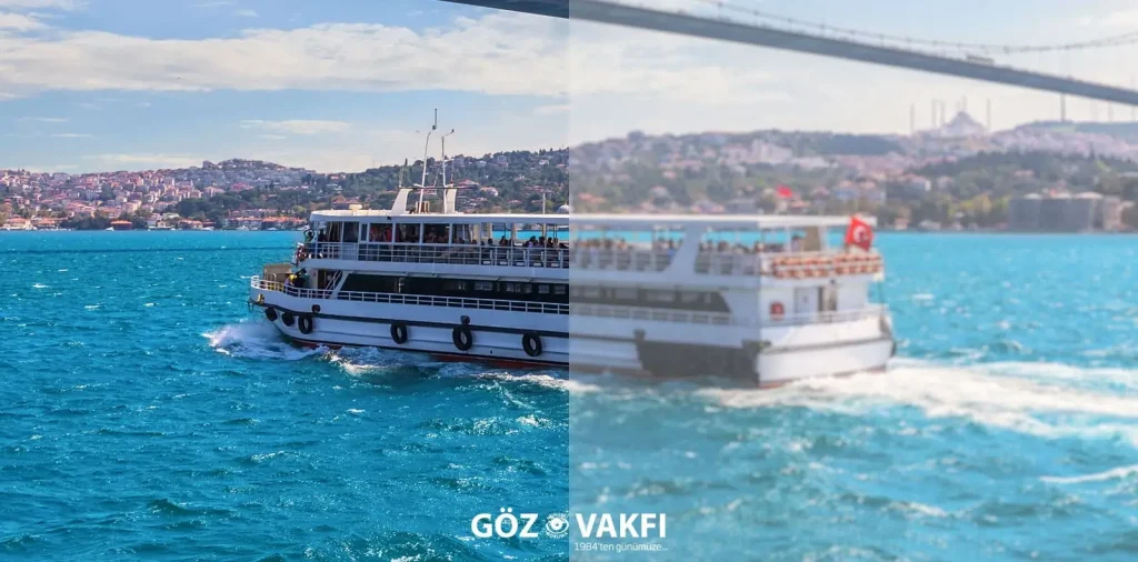 Katarakt Cerrahisi