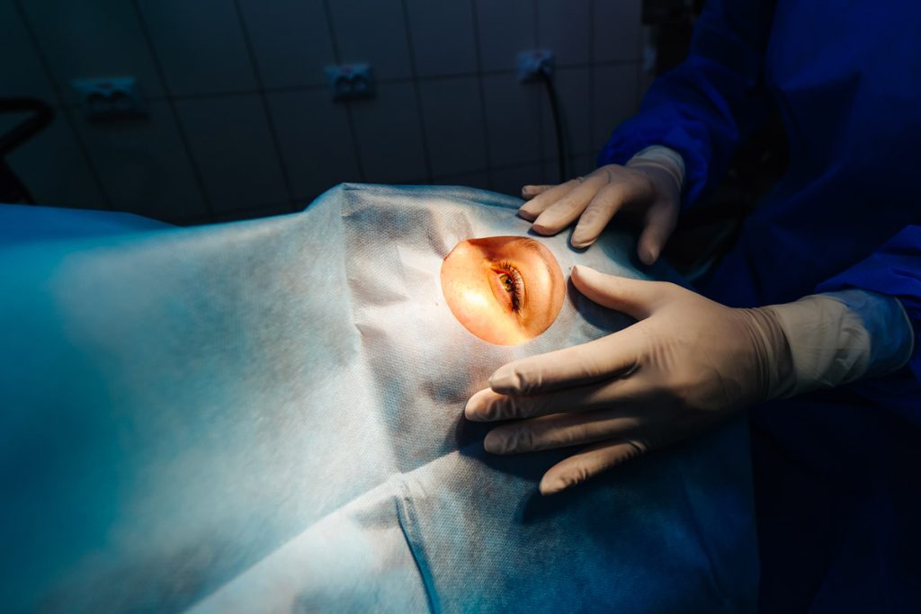 Lazer Teknolojisi Avantaj Sağlıyor, Femtosaniye Lazer