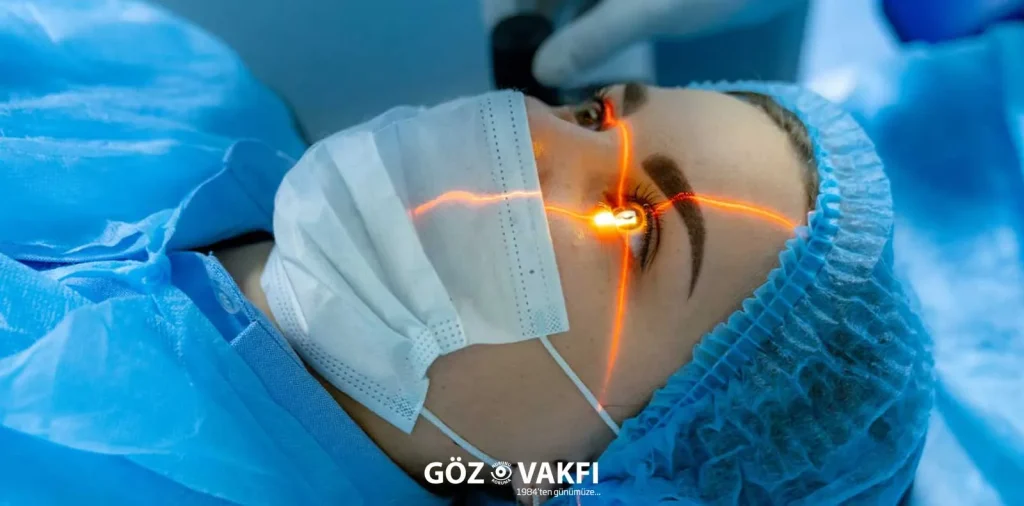 Lazerler Göz Çizdirme (Refraktif Cerrahi)